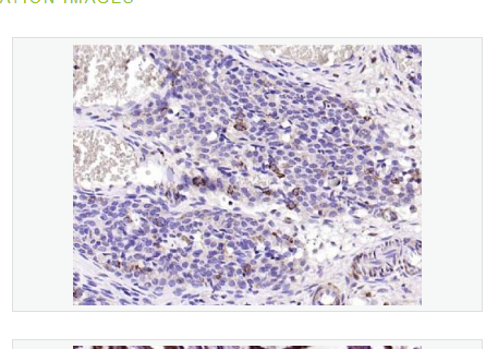 Anti-CD200 antibody-膜糖蛋白CD200抗体