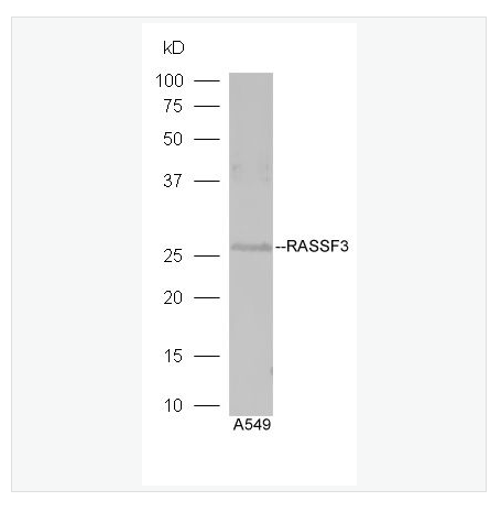 Anti-RASSF3 antibody-Ras相关区域家族1A抗体