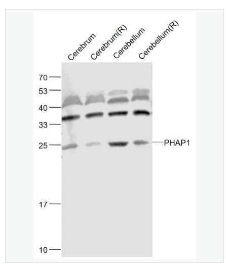 Anti-PHAP1 antibody-蛋白磷酸酶2A抑制剂1抗体