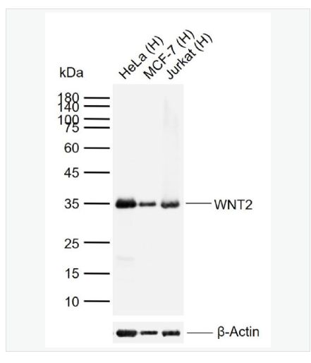 Anti-WNT2 antibody-信号通路Wnt2抗体