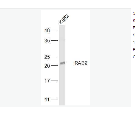 Anti-RAB9  antibody-ras癌基因家族Rab9蛋白抗体