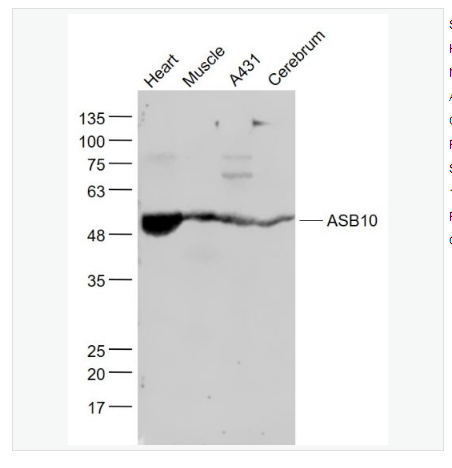 Anti-ASB10 antibody-含锚蛋白重复序列-细胞因子信号抑制物盒蛋白家族10抗体