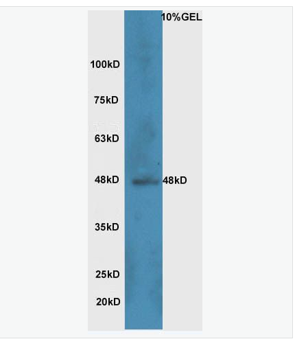 Anti-Wnt8b antibody-WNT蛋白家族Wnt8b抗体