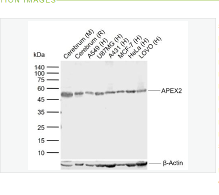 Anti-APEX2  antibody-嘌呤嘧啶核酸内切酶2抗体