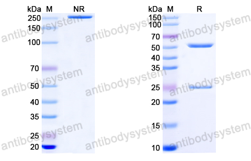 Anti-HIV-1 Capsid protein p24/CA protein Antibody (A3)