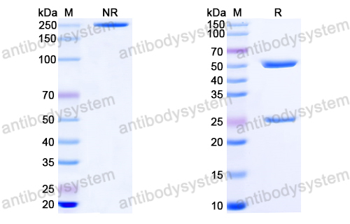 Anti-EBV/HHV-4 gL/BKRF2 Antibody (E1D1)