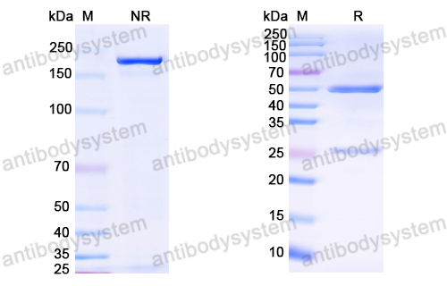 Anti-HCV NS1/gp68/gp70/Envelope glycoprotein E2 Antibody (22D11)