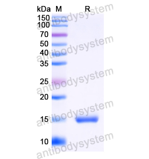 Anti-HIV-1 Vif/SOR protein Antibody (SAA1421)