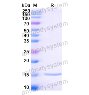 Anti-HIV1 Surface protein gp120 Nanobody (SAA0882)