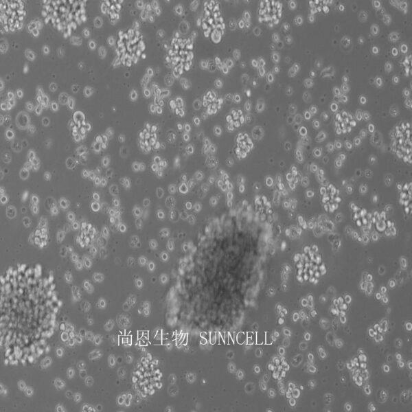 MT-4人T细胞白血病细胞