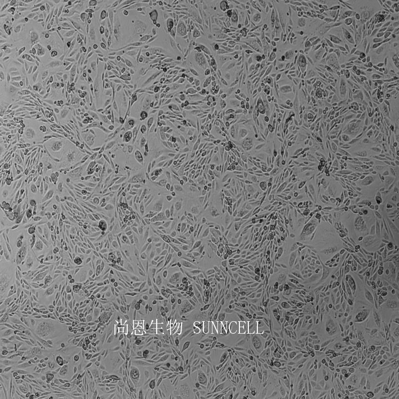 仓鼠卵巢细胞（二氢叶酸还原酶缺陷）
