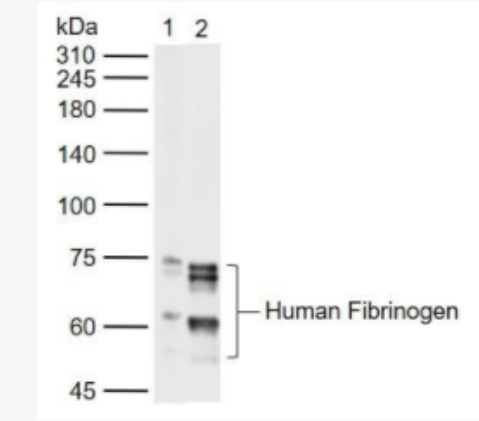 Fibrinogen alpha chain  纤维蛋白原A链抗体