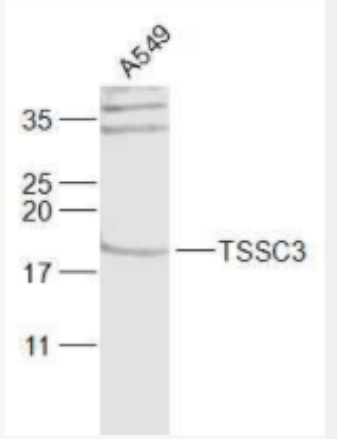 TSSC3 肿瘤抑制转移候选基因3抗体