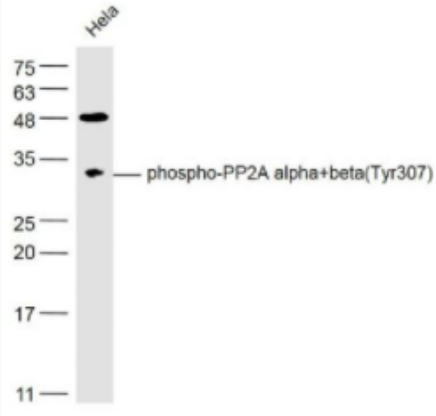 phospho-PP2A alpha+beta (Tyr307) 磷酸化蛋白磷酸酶2A（PP2Aα）抗体