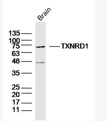 TXNRD1 硫氧环蛋白还原酶1抗体