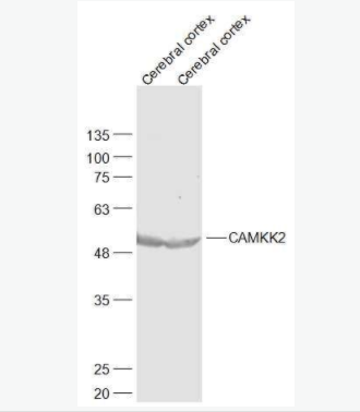 CAMKK2 钙调蛋白激酶激酶β抗体