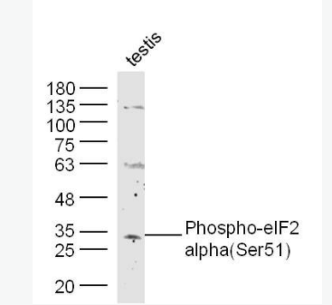 Phospho-EIF2S1 (Ser51) 磷酸化真核启动因子2α抗体