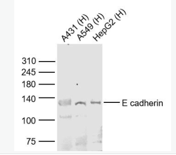 E cadherin 上皮钙粘附分子抗体