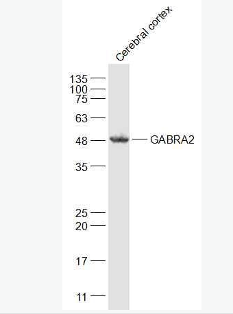 GABRA2 G氨基丁酸A型受体α2/GABAA Rα2抗体