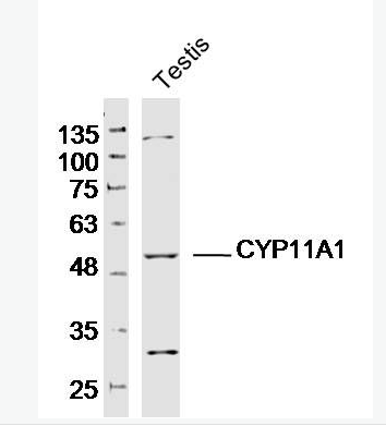 CYP11A1 细胞色素P450 11A1抗体