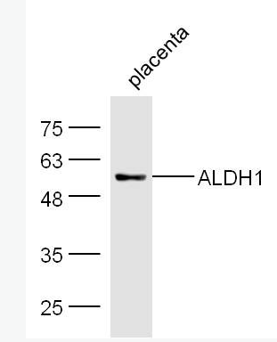 ALDH1A1 乙醛脱氢酶1型抗体