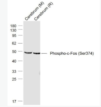 Phospho-c-Fos (Ser374) 磷酸化c-fos抗体