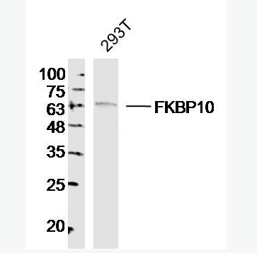 FKBP10 肽基脯氨酰顺反异构酶FKBP10抗体