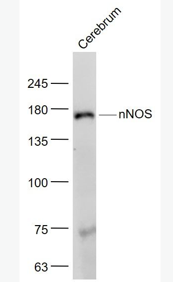 nNOS 一氧化氮合成酶-1（神经型）抗体