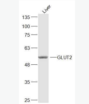 GLUT2 葡萄糖转运蛋白2抗体