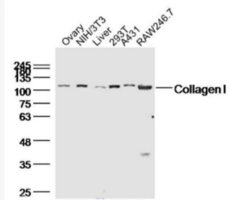 Collagen I I型胶原蛋白/胶原蛋白1/1型胶原蛋白/I型胶原a1抗体