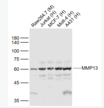 MMP13 基质金属蛋白酶13抗体