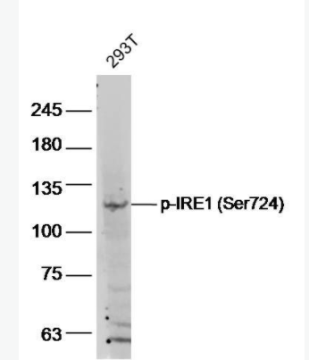 phospho-IRE1 (Ser724) 磷酸化IRE1蛋白抗体