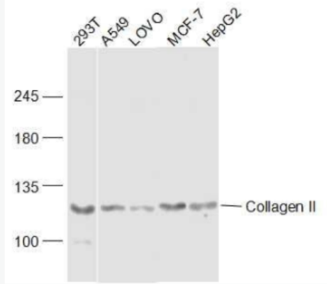 Collagen II Ⅱ型胶原蛋白抗体