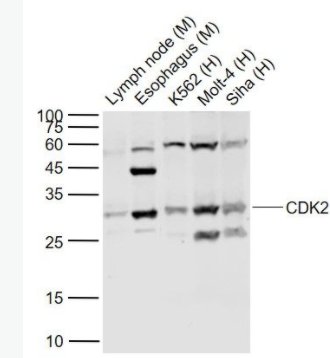 CDK2 周期素依赖性激酶2抗体