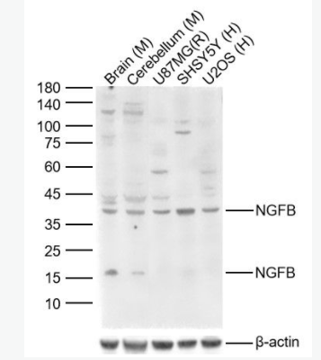 NGFB 神经生长因子β抗体