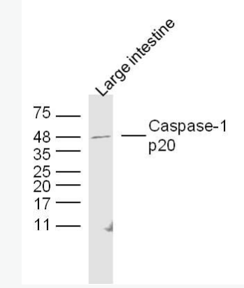 PPP3CC 蛋白磷酸酶3调节亚基C抗体