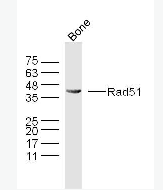 Rad51 Rad51抗体