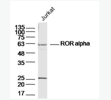 ROR alpha 维甲酸相关孤儿受体α抗体