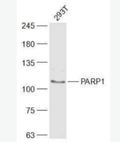PARP1 多腺苷二磷酸多聚酶抗体/多聚ADP-核糖聚合酶1抗体