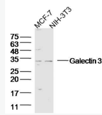 Galectin 3 半乳糖凝集素3抗体