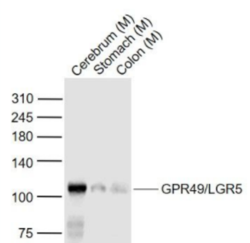 GPR49/LGR5 G蛋白偶联受体49抗体