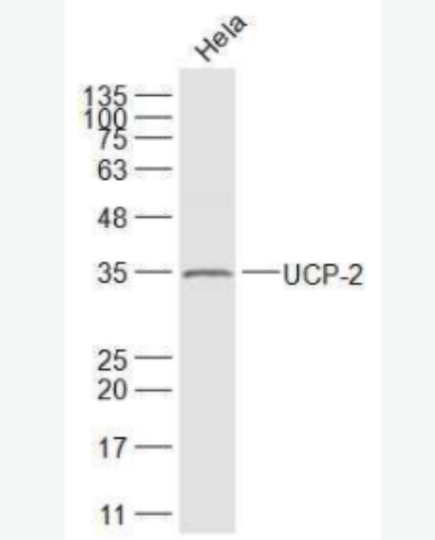 UCP-2  线粒体脱偶连蛋白2抗体