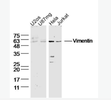 Vimentin波形蛋白抗体