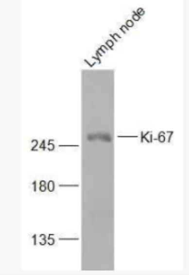Ki-67 Ki67蛋白抗体