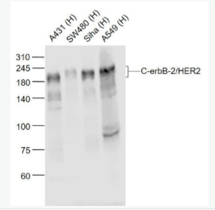 C-erbB-2/HER2 HER2单克隆抗体