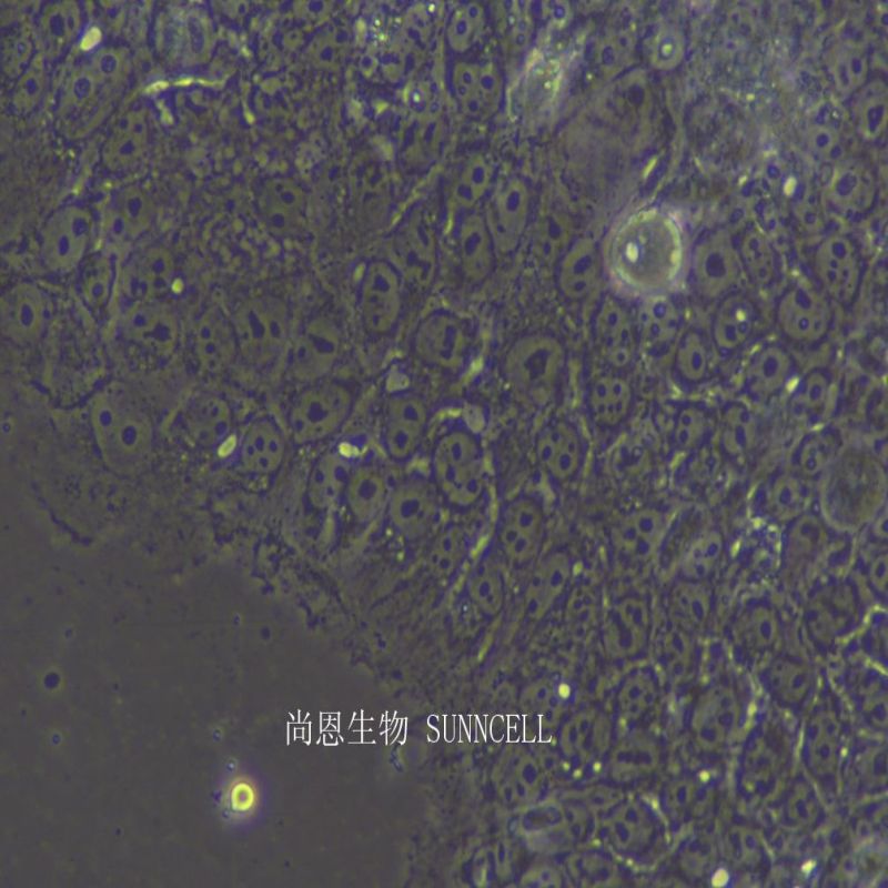 人绒毛膜肿瘤细胞