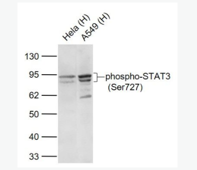 phospho-STAT3 (Ser727) 磷酸化信号转导和转录激活因子3重组兔单克隆抗体