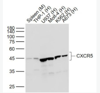 CXCR5 细胞表面趋化因子受体5（CD185）重组兔单克隆抗体