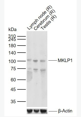 MKLP1 有丝分裂驱动蛋白样1重组兔单克隆抗体