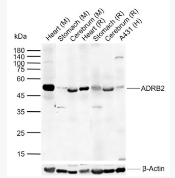 ADRB2 肾上腺素能受体β2/β2-AR抗体